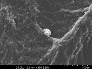 scanning electron microscopy